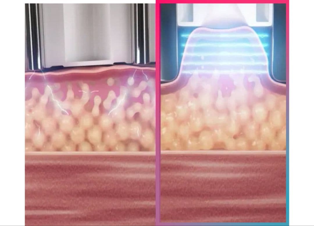 MEDICUBE メディキューブ AGE-R ボディショット