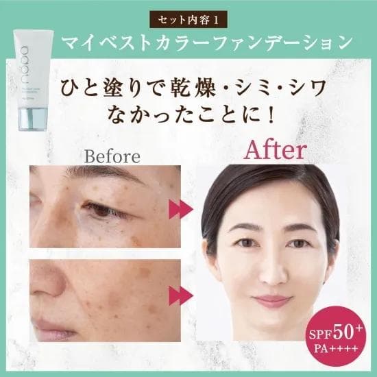 nopa ビューティーボックスセット