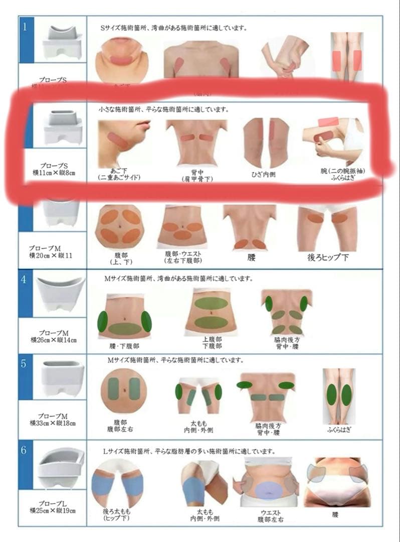 脂肪冷却 顎、二の腕用ハンドル