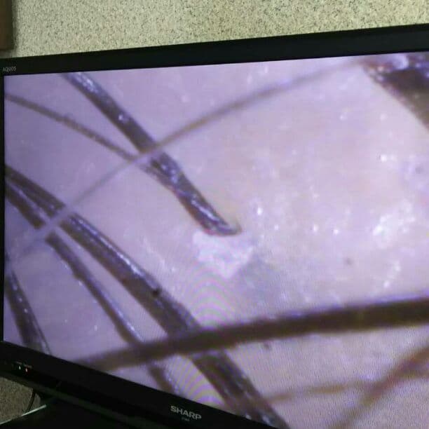 マイクロスコープ