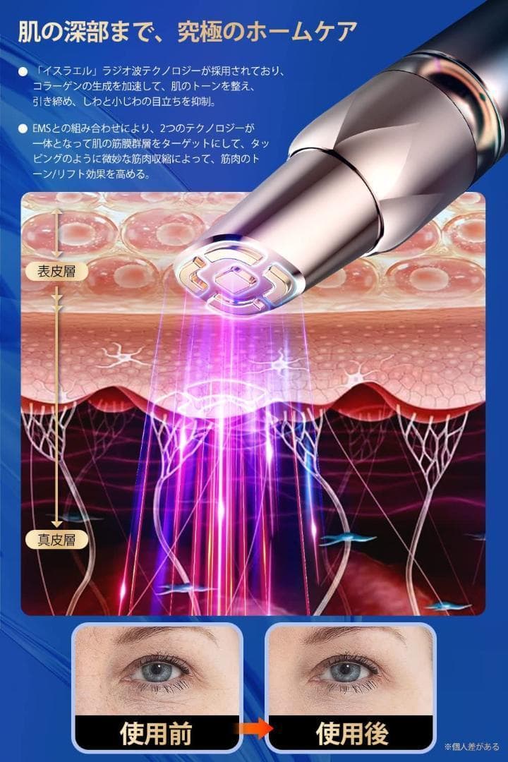 ★目元美顔器 3in1目元ケア★ RF美顔器 引き締め 美顔器EMS ★