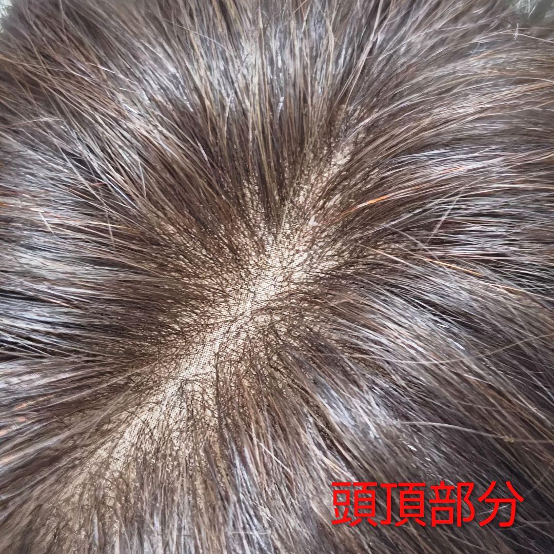 アートネイチャー アンクス AC01 LA5 医療用ショートウィッグ Sサイズ