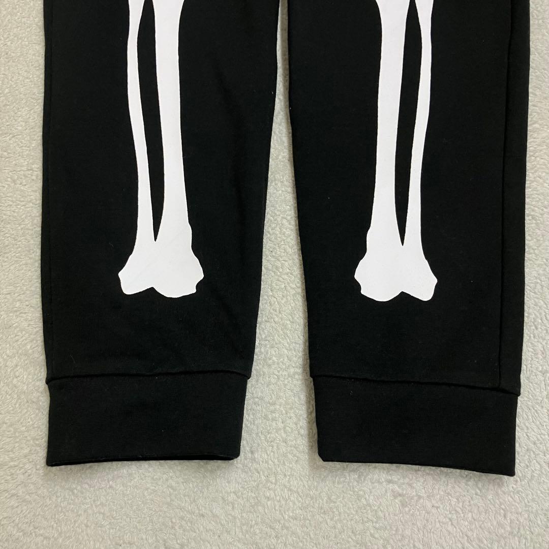 ベビーメタル BABYL 骨パーカー＆パンツ セットアップ Mサイズ