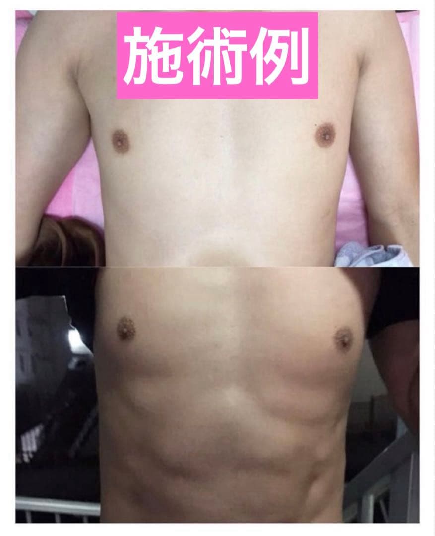 業務用痩身マシン/EMS/電磁パルス/寝たまま筋トレ/エステ機器/美容マシーン