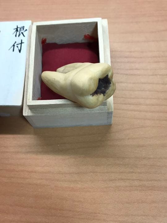 根付サンプル　虫歯　銘:貞道