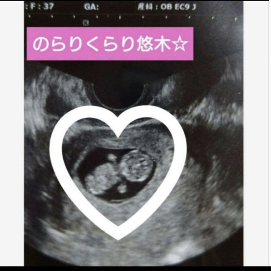 ①ハロウィンフェア✨波動コアオルゴナイトセット