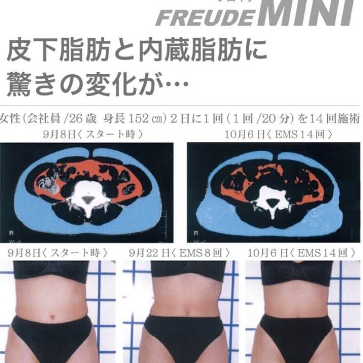 ボディ・フェイスケア FREUDE-mini