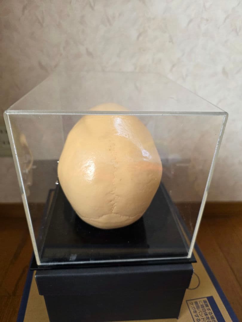 NISSIN DENTAL PRODUCTS 頭蓋骨模型 アンティーク ガイコツ