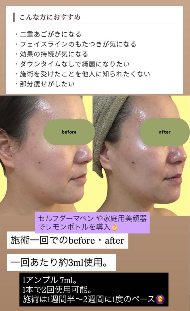 ルル　サリチル酸ピーリング1本+レモンボトル1本