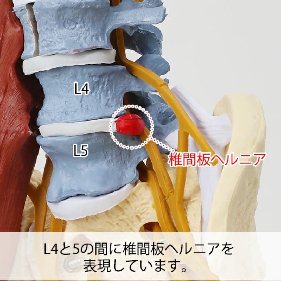 〈7ウェルネ〉脊椎模型 (主要筋・靭帯・神経、血管付) 実物大