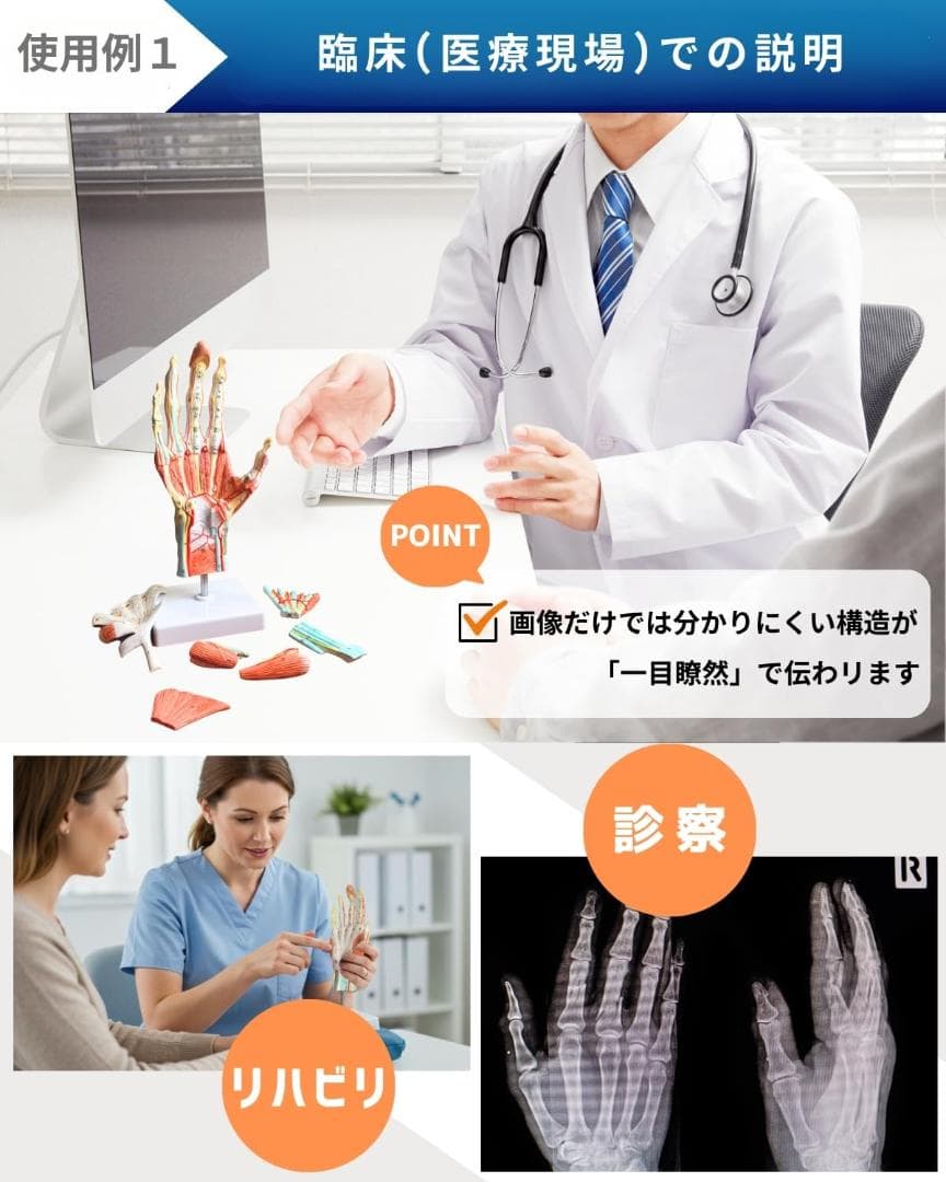 手解剖模型 7パーツ分解 原寸大 軟部組織付き 理学療法士監修 人体模型 手関節