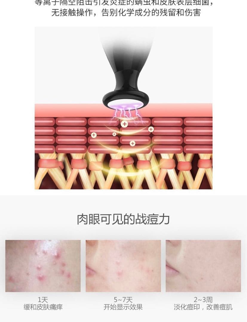 プラズマペン　繰り返すニキビ肌に　肌荒れに　業務用・セルフok