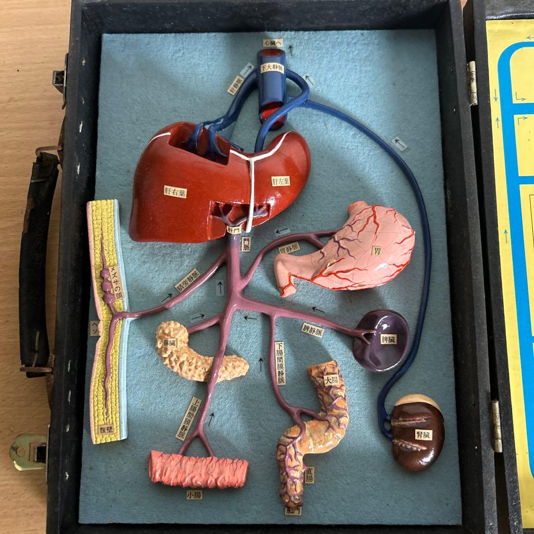 超レア　門脈系模型