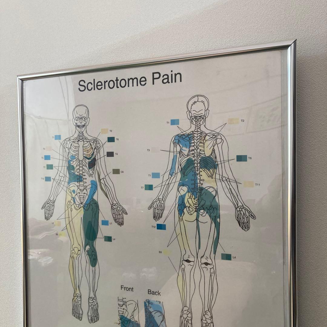 Sclerotome Pain 解剖図！カイロ！整体！鍼灸！エステ！トレーナー！