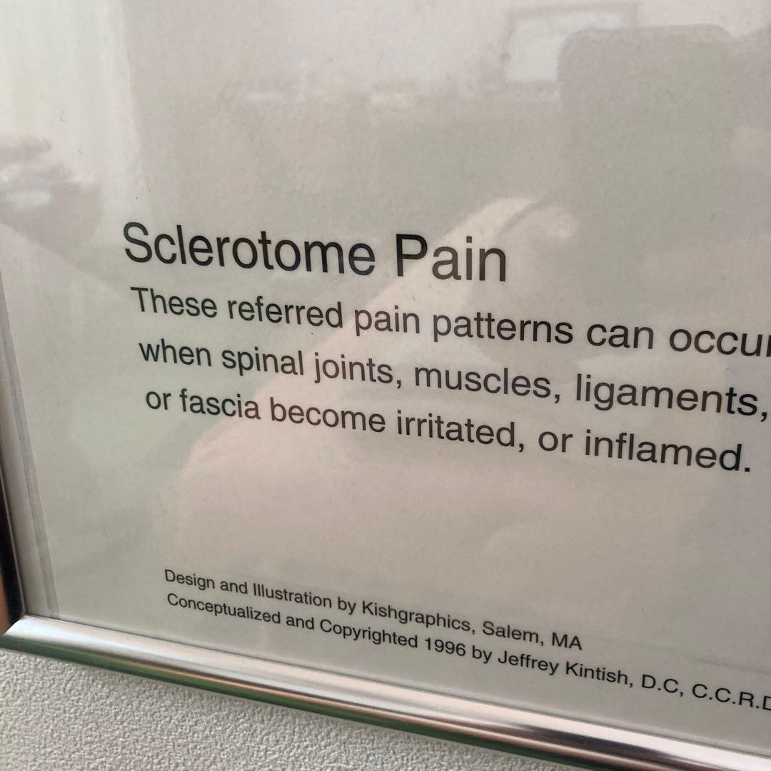 Sclerotome Pain 解剖図！カイロ！整体！鍼灸！エステ！トレーナー！