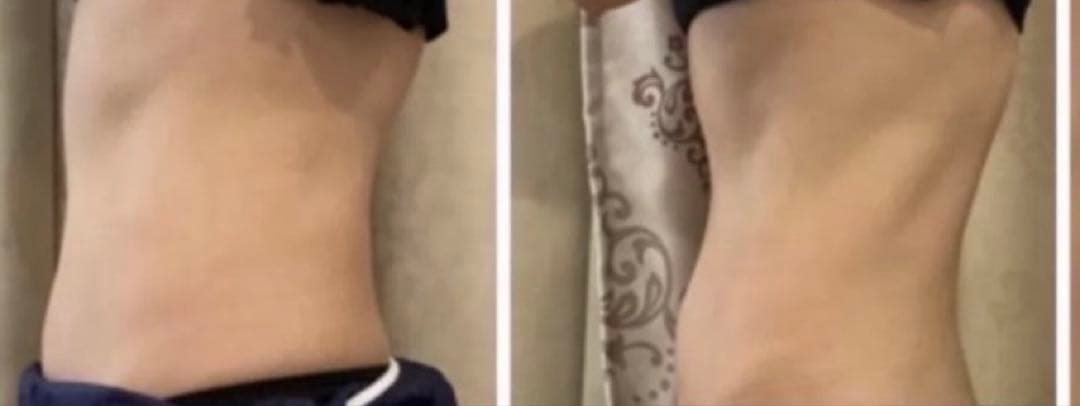 痩身機/業務用痩身マシン/EMS/電磁パルス/筋トレ/エムスレンダー