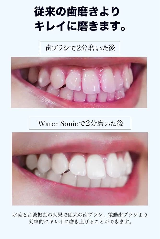 未使用 WaterSonicフルセット 歯垢除去率130%ジェット電動歯ブラシ