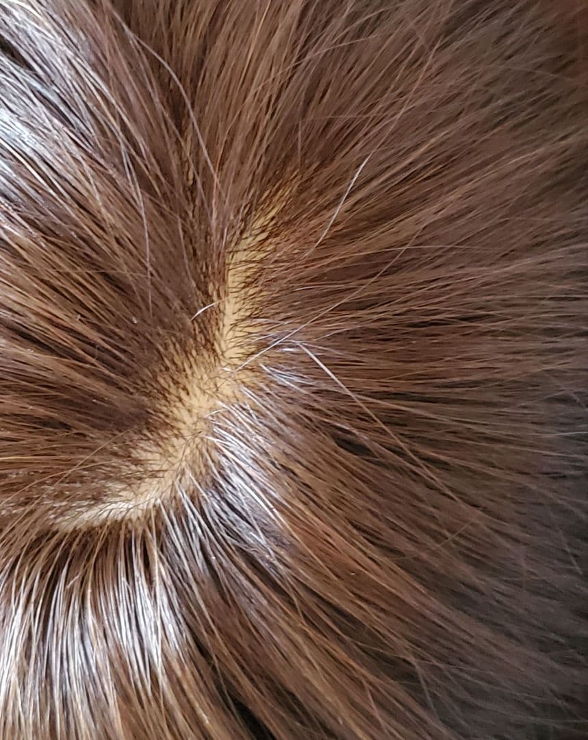 百合子ウイッグレミー人毛100%　Mサイズ　スキンレースタイプ