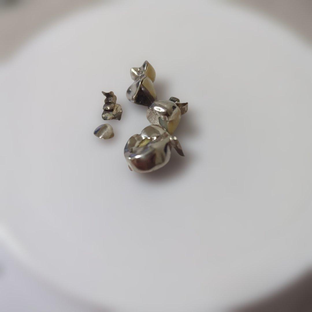 m*o様 銀歯/被せ物