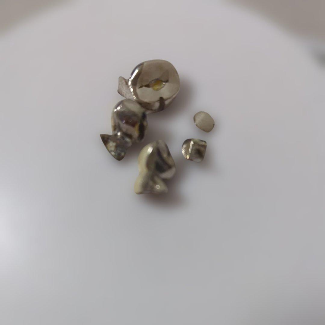 m*o様 銀歯/被せ物