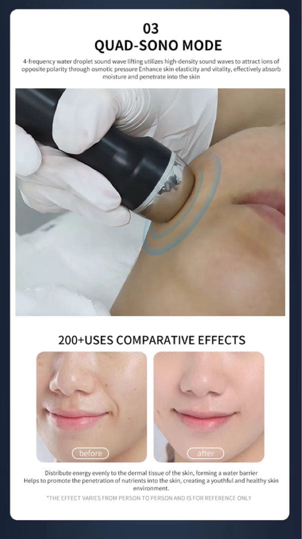 プラズマ・ワンモード ・LDM