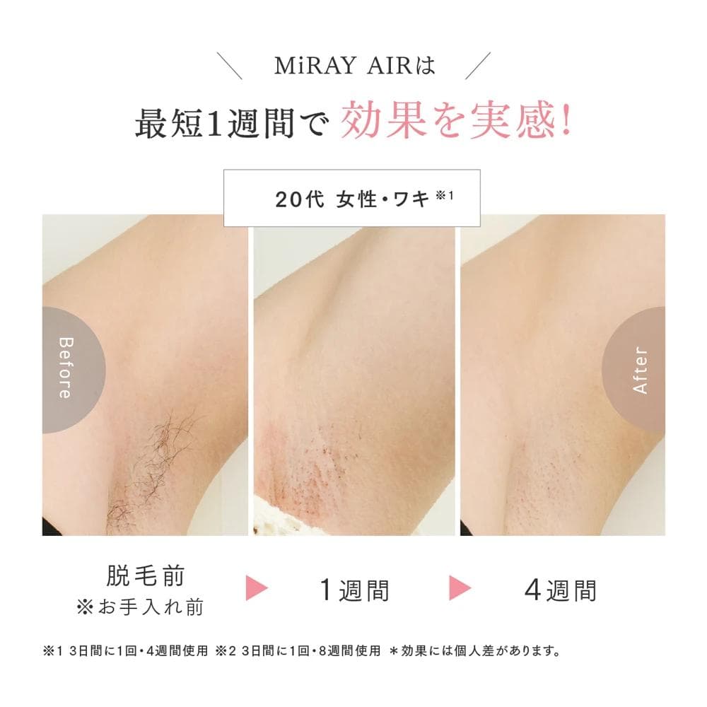 新品未使用 MYTREX MiRAY AIR マイトレックス 美顔器