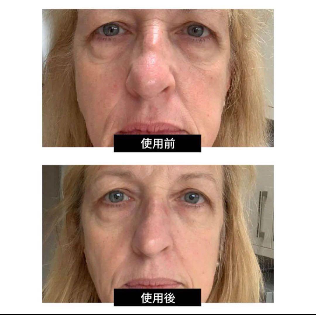 新品未使用☆カレントボディLEDマスク☆